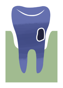 Icon Tooth Materials