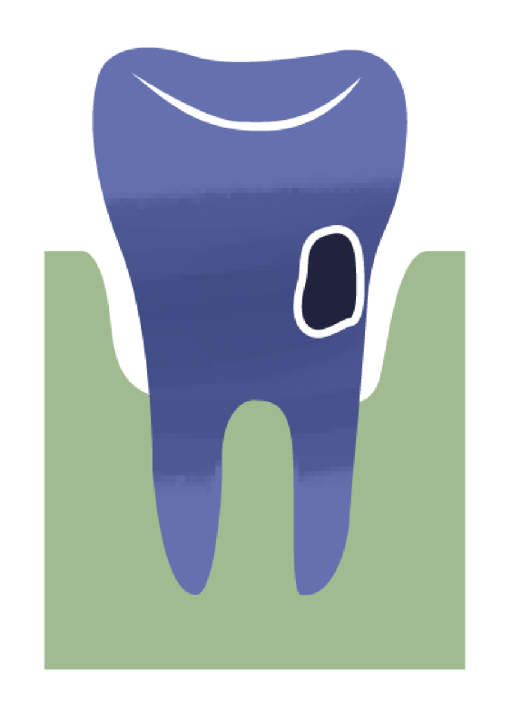Icon Tooth Materials